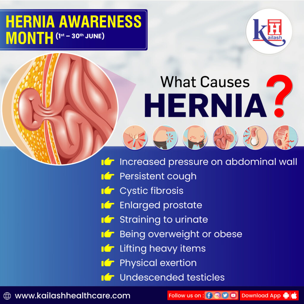 Sports Physical Hernia Checks: Complete Guide to Requirements and Procedures